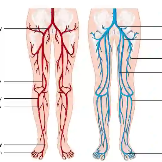 MR Angiography (MRA) of Both Lower Limbs